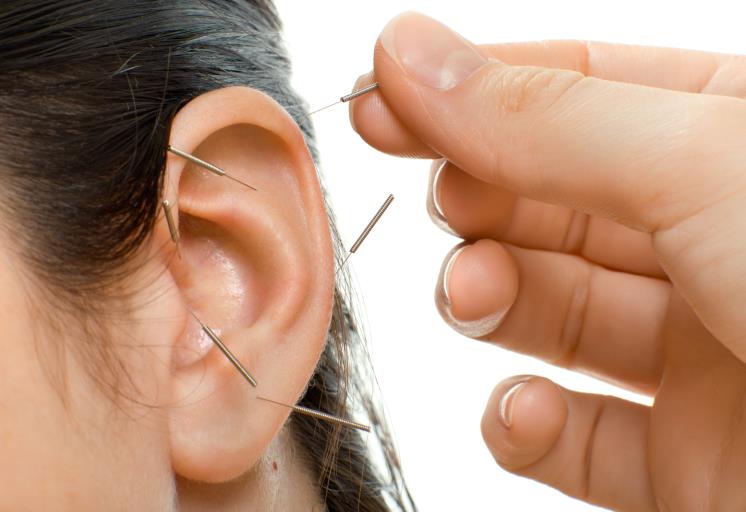 acupuncture therapy on auricle, horizontal very close up photo